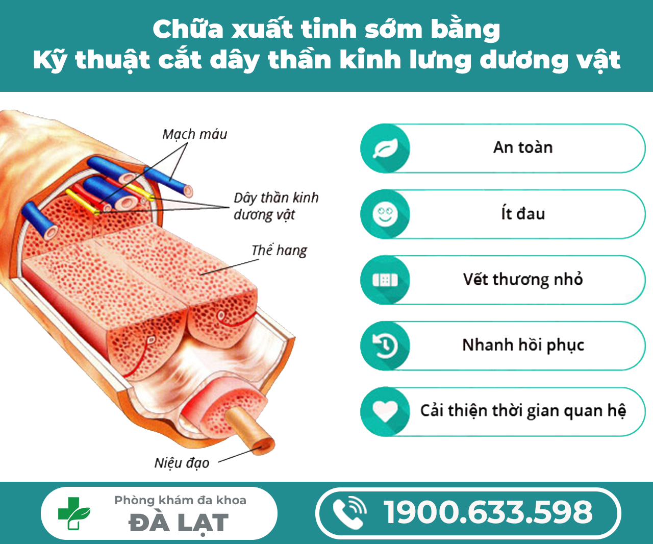 Hình ảnh minh họa